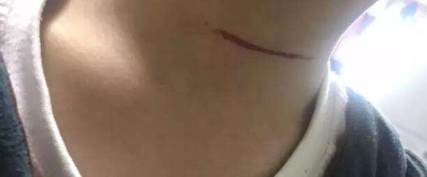 河北一女士骑车路上遭“暗算”！警惕这一隐形“杀手”！